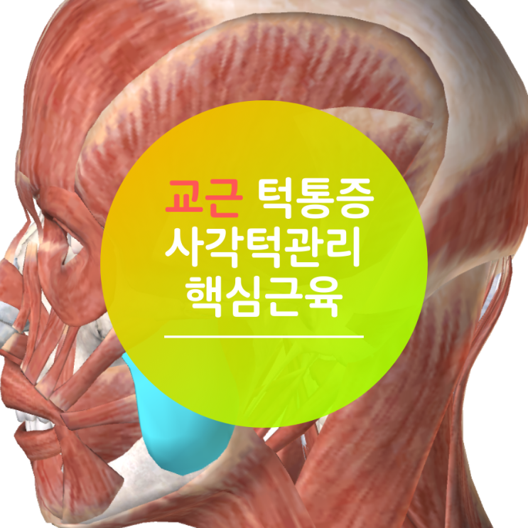  교근은 턱통증 및 사각턱의 핵심 근육