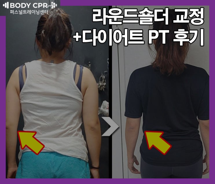  [노원PT] 골반비대칭에서 라운드숄더 체형교정 PT 트레이닝과정