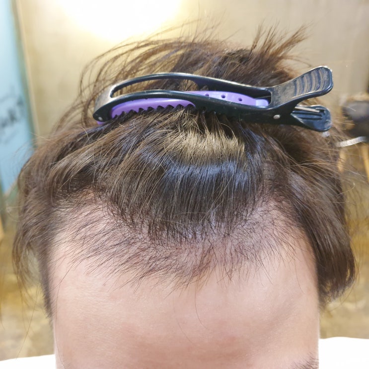  남자 앞머리 기르기 어렵다면?