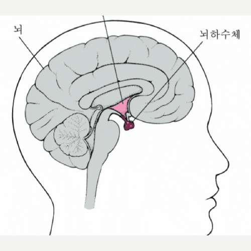  시상하부 뇌하수체 이상 성장호르몬저하 |  유니시티코리아 유여림