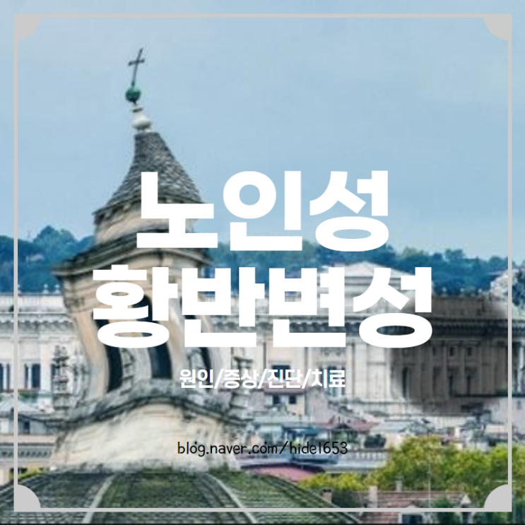  노인성 황반 변성