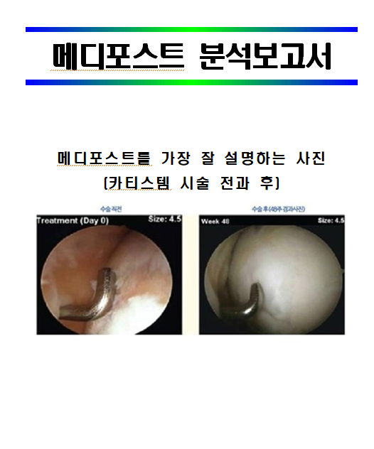  바이오기업(줄기세포) 메디포스트 분석보고서