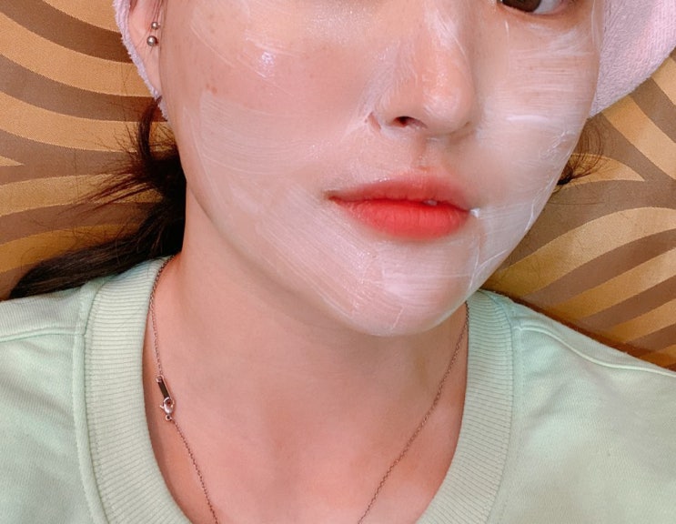  주근깨 제거 레이저 시술 1회차