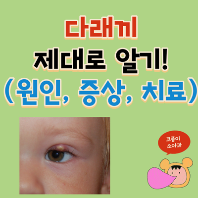  아기 다래끼 제대로 알기!(원인, 증상, 치료, 전염)