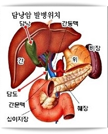 담도암 증상 및 원인 치료 방법, 생존율