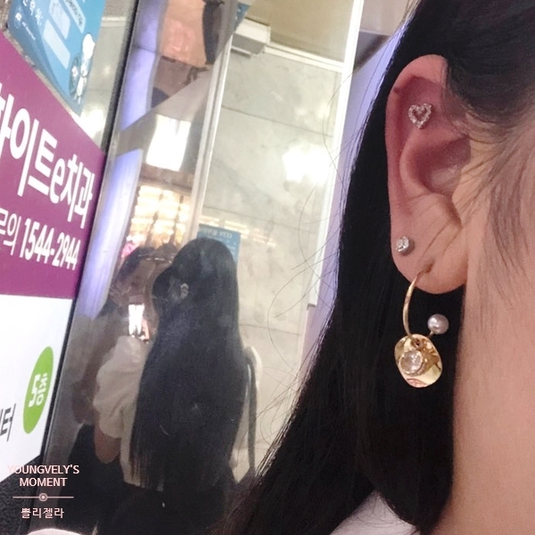  부산 귀 켈로이드 주사 1탄 (부산 켈로이드 병원 / 부산 켈로이드 / 부산 피어싱/ 부산 피부과)