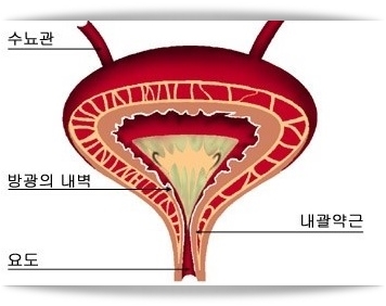  여자 방광암, 남자 방광암 증상 및 원인, 치료방법