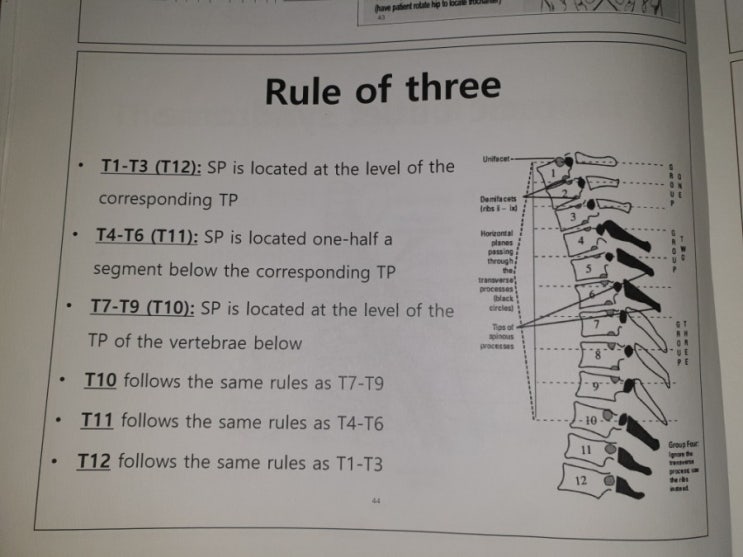  흉추 극돌기로 흉골 바디 찾기 rule of three