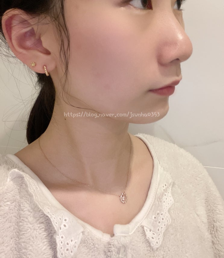  시카케어 아크네 폼클렌징으로 좁쌀여드름 관리하자