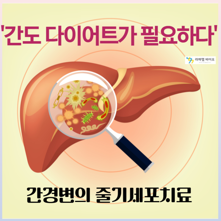  간경변 치료는 줄기세포보관으로 부터~