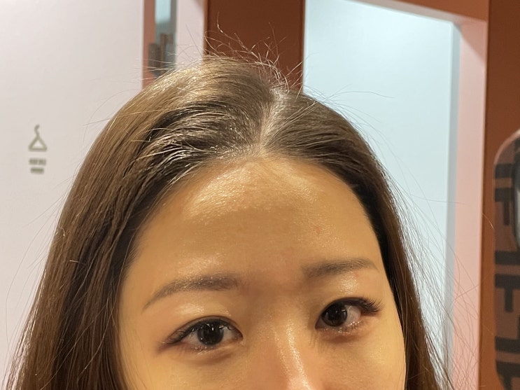  강남 여드름관리 여드름피부 피부관리 LDM 후기.