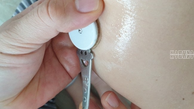[1형당뇨] 리브레 제거하기