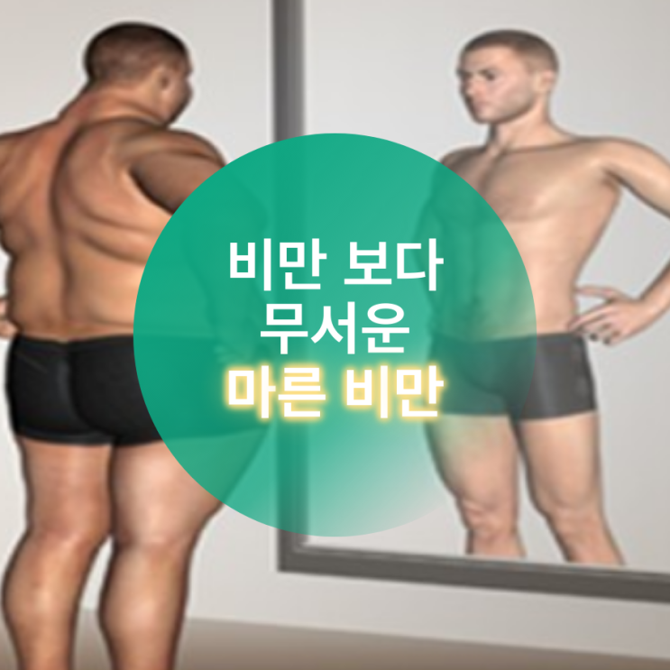  비만보다 무서운 마른 비만