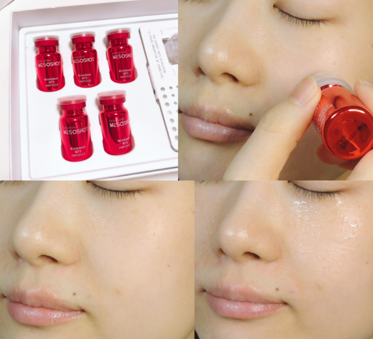  모공 줄이는법 뷰티영 메조샷 링클아웃 MTS롤러 앰플로 해결