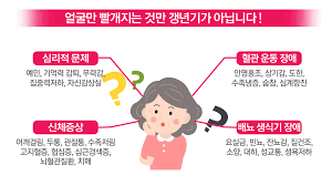 갱년기주요감정 약물요법운동 골다공증식이요법 비뇨기계감염 케겔운동 폐경우울증 갱년기주요감정 약물요법운동 골다공증식이요법 비뇨기계감염 케겔운동 폐경우울증