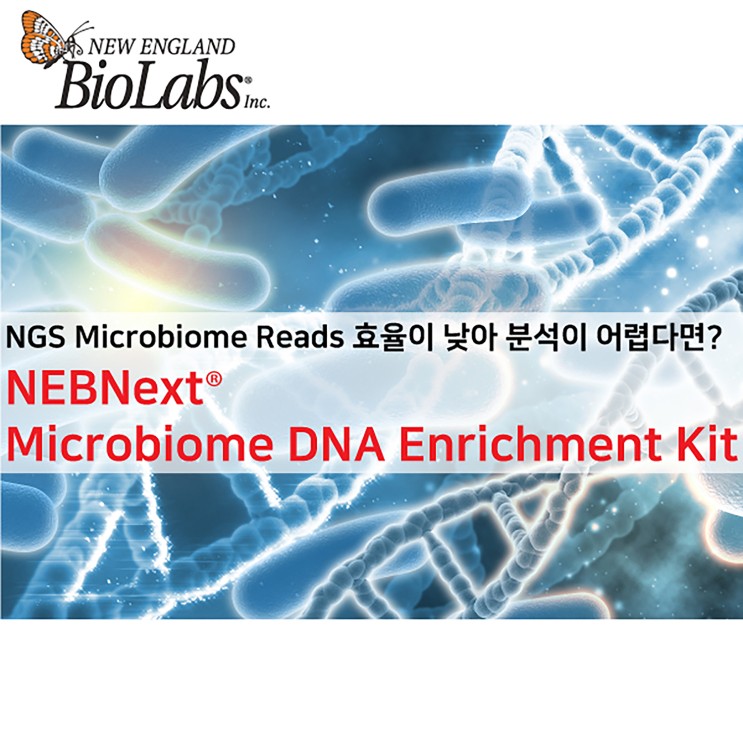 NGS Microbiome 분석 , 높은 효율 시약으로 걱정 없이 완료!