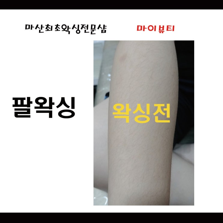  [마산/창원왁싱] 팔왁싱 사진, 팔왁싱 관리는 언제?? 팔왁싱리뷰