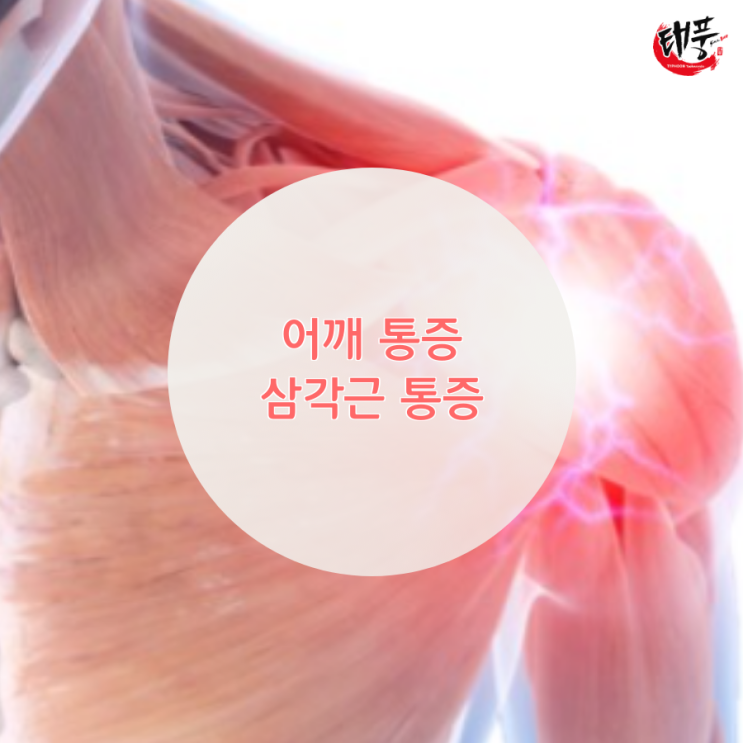  팔 어깨 통증 중 삼각근 통증 스트레칭