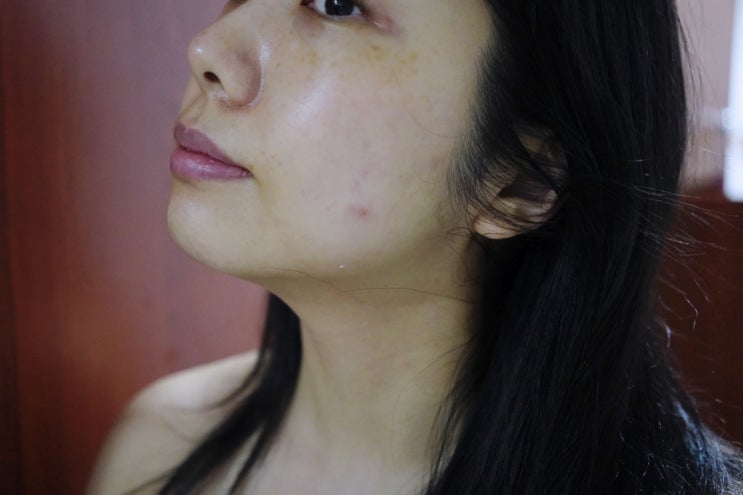  목동피부관리 현에스떼 브이라인으로 살아난 얼굴선