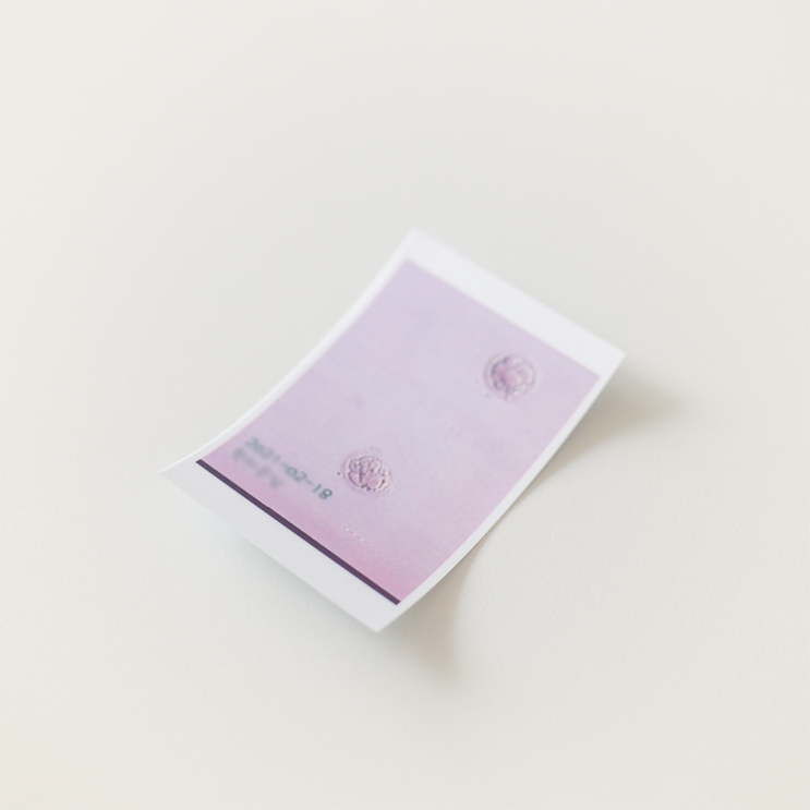  세번째 난임일기_노원메디아이/시험관 1차/시험관 증상/신선이식