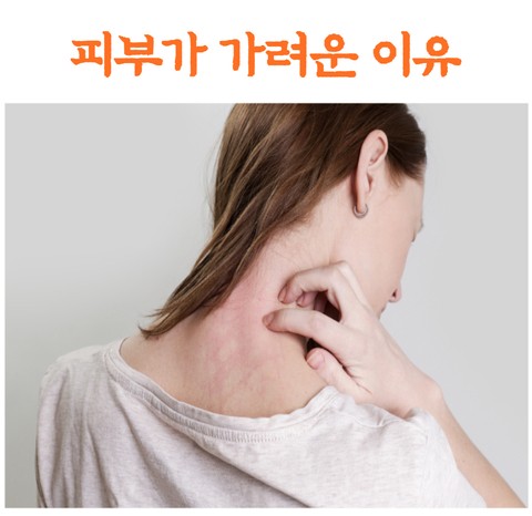  피부가 가려운 이유