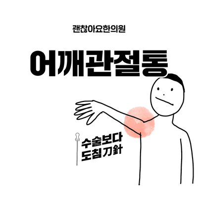  공덕역 도침치료 어깨관절통증, 공덕 도침한의원