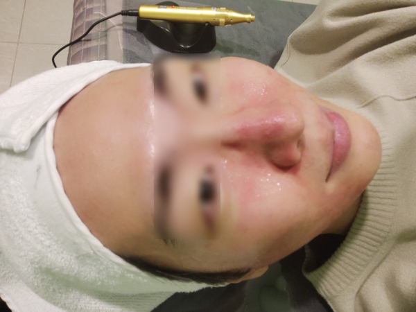  스킨부스터 데모가 들어왔다..
