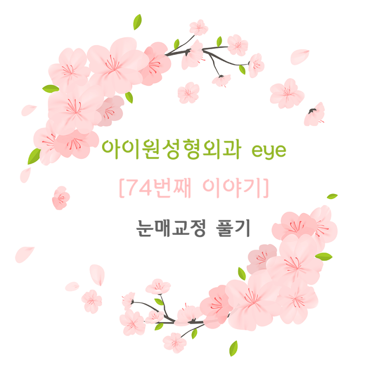  [아이원성형외과 eye] 쌍꺼풀 푸는수술과 눈매교정 푸는 수술