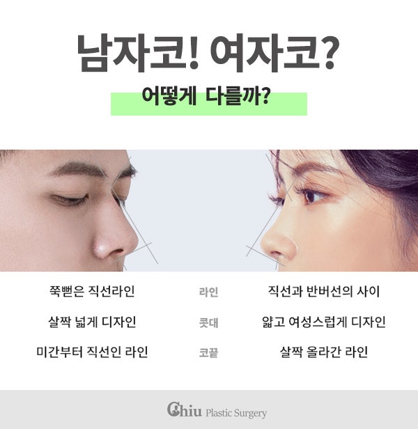 남자코성형, 진짜 원하던 직선코라인! : 네이버 블로그 남자코성형, 진짜 원하던 직선코라인! : 네이버 블로그
