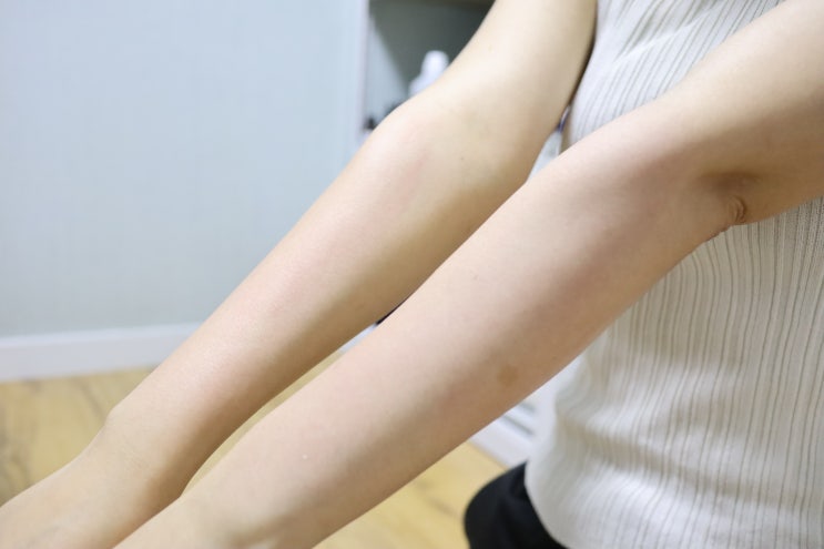  셀프왁싱 페리샤 롤러로 편하게 하는 팔왁싱