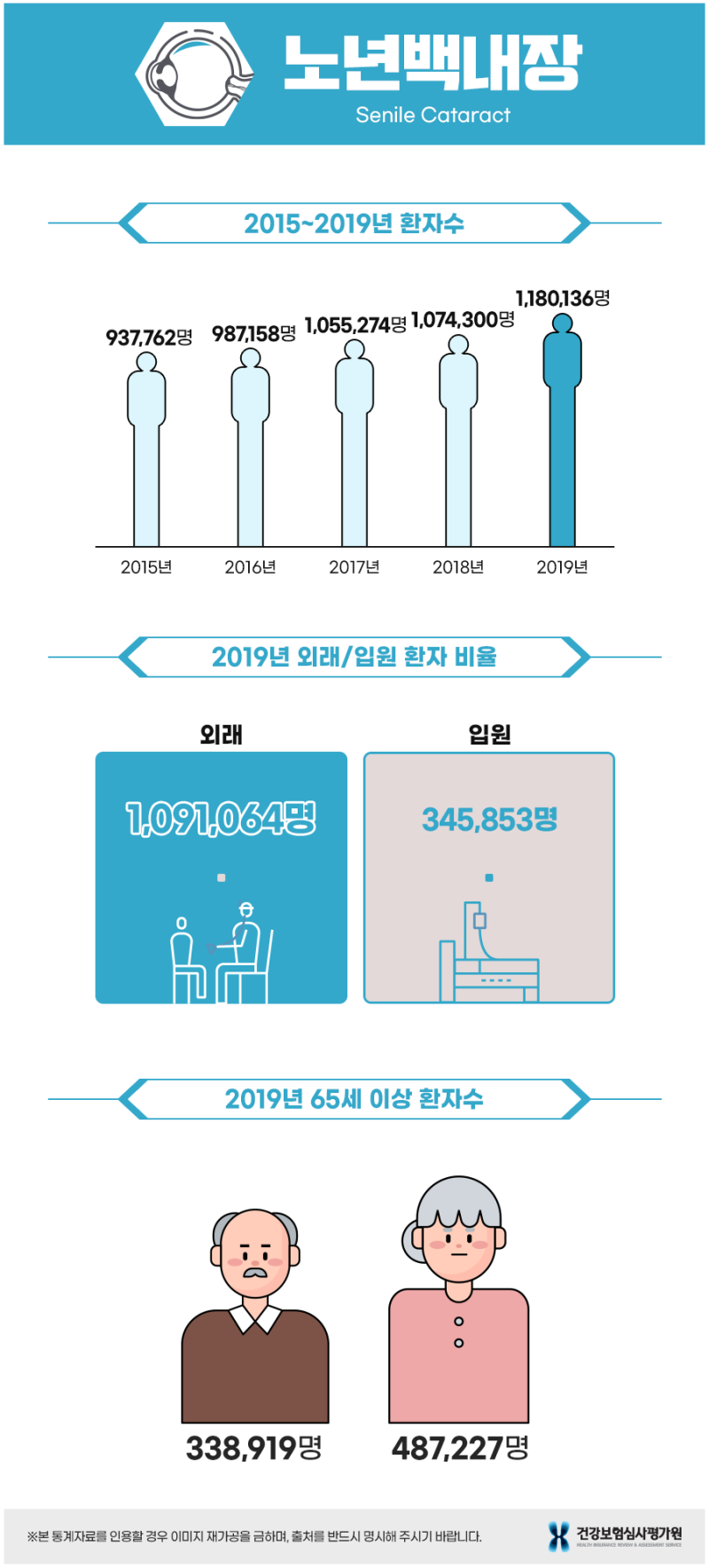 20대, 30대 백내장의 원인을 미리 알아야 합니다.