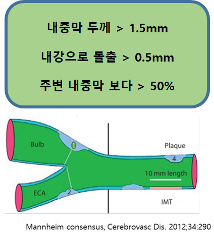  경동맥 초음파 - 죽상경화반(플라크)과 경동맥 협착 + 치료