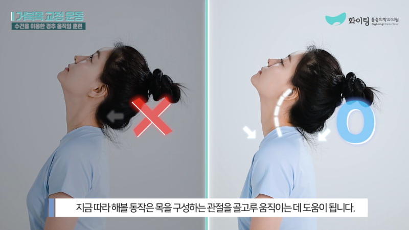 거북목 일자목 등통증 운동으로만 자세 교정하기 힘들때