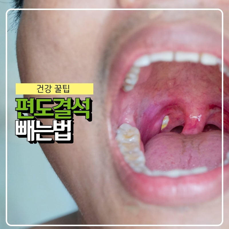 주간일기)ETF공부/편도전/오징어집