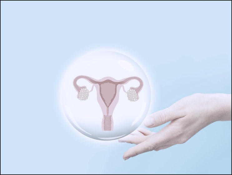  자궁내막증 복강경, 불임이 걱정되는 분들은 보세요