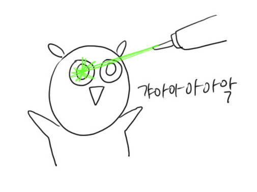  시력교정술 라섹 수술 당일~13일차 후기