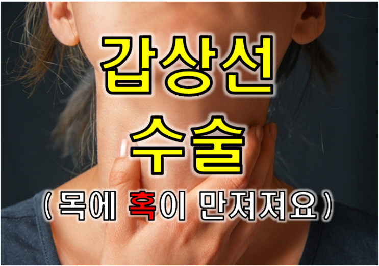  목에 멍울이 만져지는 40대 주부 - 갑상선 수술의 모든것