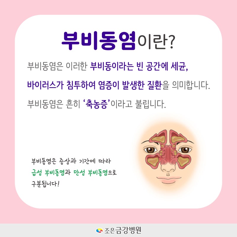 부비강염 감기로 착각하기 쉬운 급성 부비강염의 원인, 증상, 치료