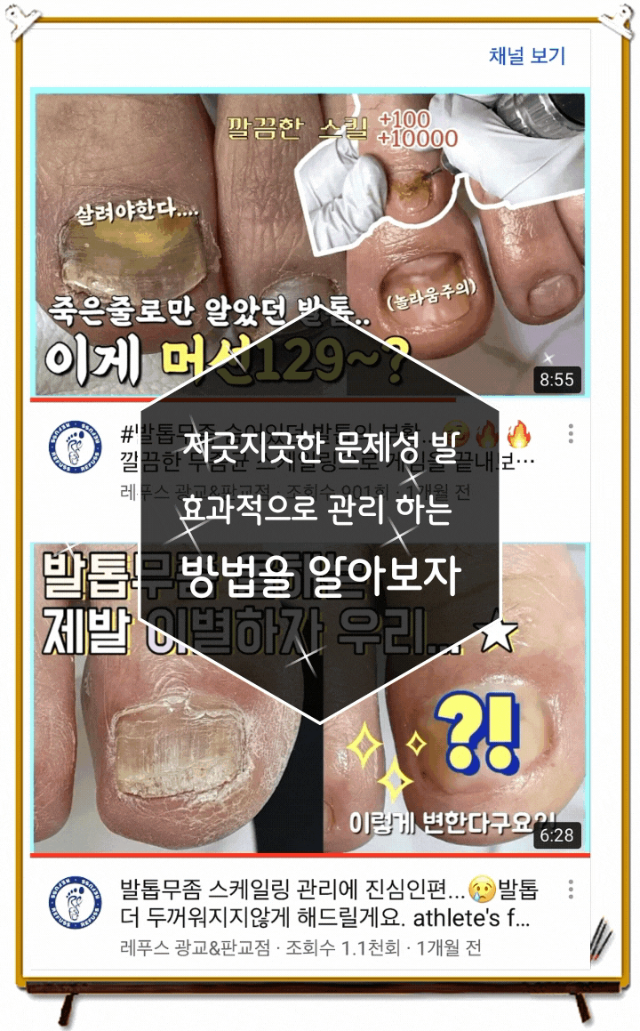  분당내성발톱 케어도 안전하게 레푸스판교점