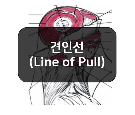 근육 활동의 결정 - 견인선(Line of Pull)
