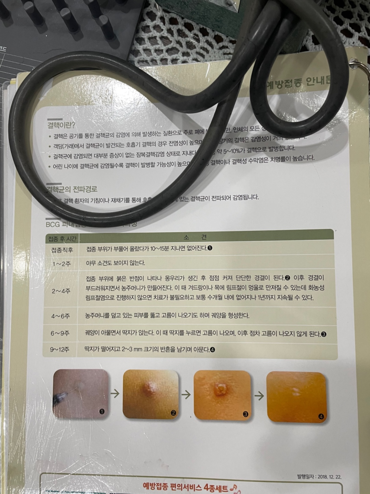  [육아일기] 신생아 BCG 접종 시기와 피내용 예약 고름 및 흉터