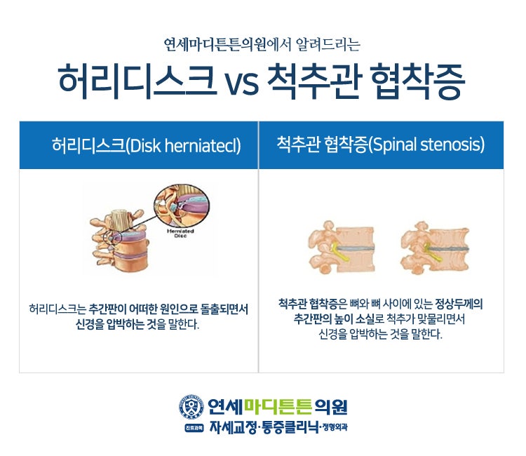 대전요통성형외과의 원인과 증상은? 2