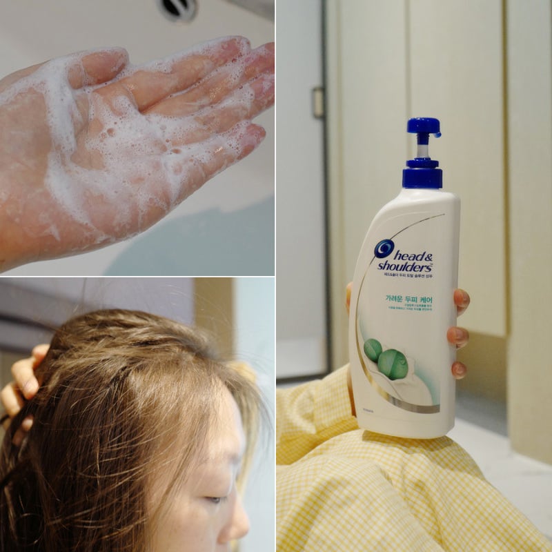 비듬 없애는 방법 홈케어로 해결해요 1