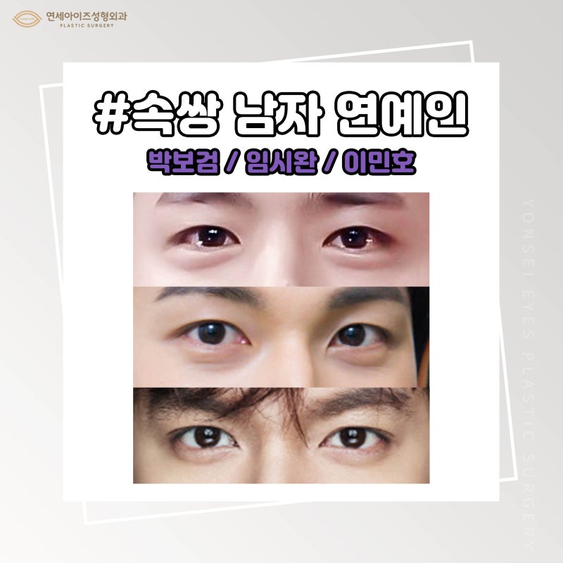 남자 속쌍커풀수술, 겉쌍 속쌍 무쌍 눈매교정 눈이 잘생긴 미남 연예인/연세아이즈성형외과 : 네이버 블로그 남자 속쌍커풀수술, 겉쌍 속쌍 무쌍 눈매교정 눈이 잘생긴 미남 연예인/연세아이즈성형외과 : 네이버 블로그