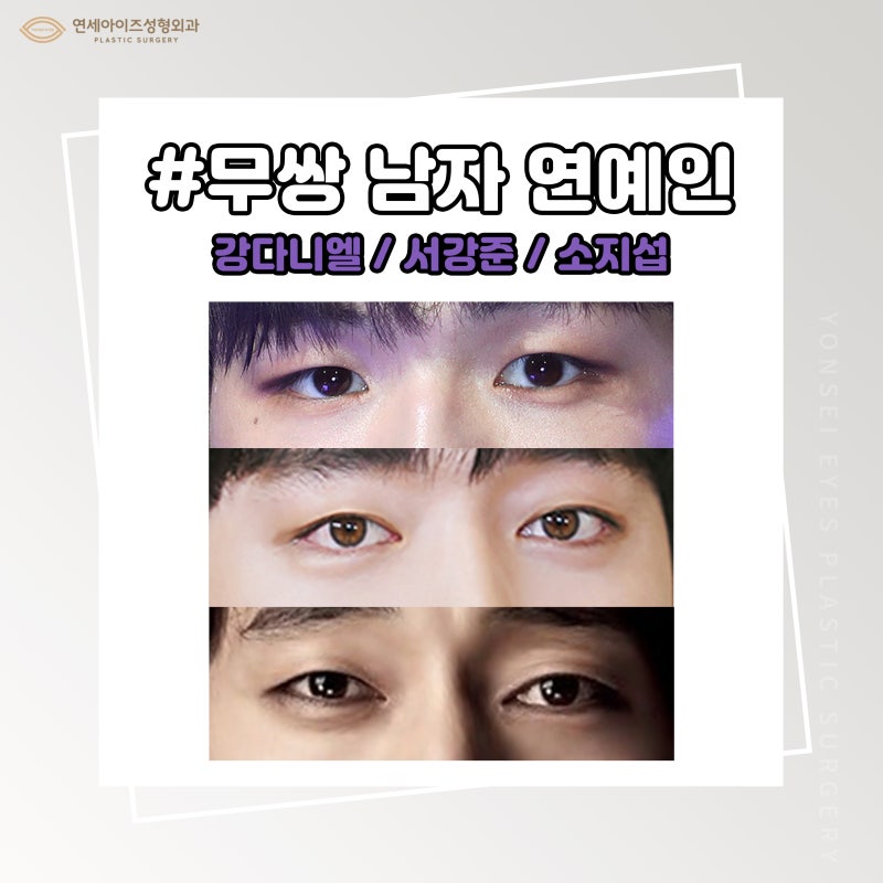 남자 속쌍커풀수술, 겉쌍 속쌍 무쌍 눈매교정 눈이 잘생긴 미남 연예인/연세아이즈성형외과 : 네이버 블로그 남자 속쌍커풀수술, 겉쌍 속쌍 무쌍 눈매교정 눈이 잘생긴 미남 연예인/연세아이즈성형외과 : 네이버 블로그