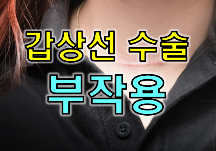  갑상선 수술을 받은 40대 주부 - 갑상선 수술의 부작용은 어떤게 있나요?