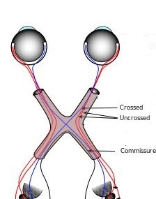  [오연식 박사, 프리즘 안경, 복시, 약시, 사시 교정, 간헐성 외사시, 간헐적 외사시, 난독증 치료, 읽기 장애, 포커싱장애, 시기능 훈련] 2021.04. 14.