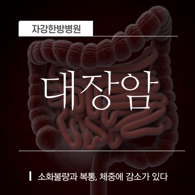  초기 대장암 증상, 원인 진단, 치료방법 및 예방은 무엇일까요?