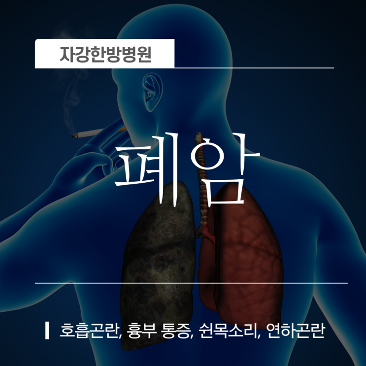  폐암 초기증상과 원인, 그리고 '예방법과 치료방법'