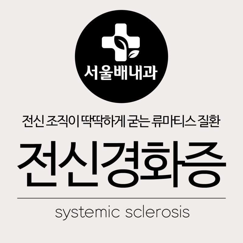 전신경화증 증상,진단, 레이노이드 현상, 혈액순환장애, 줄기세포